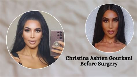 christina ashten before surgery